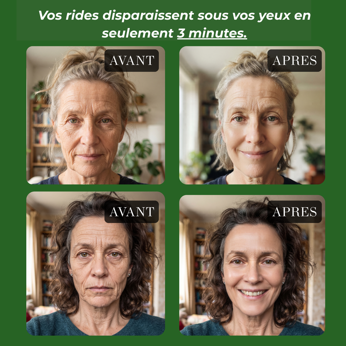 serum Anti ride
