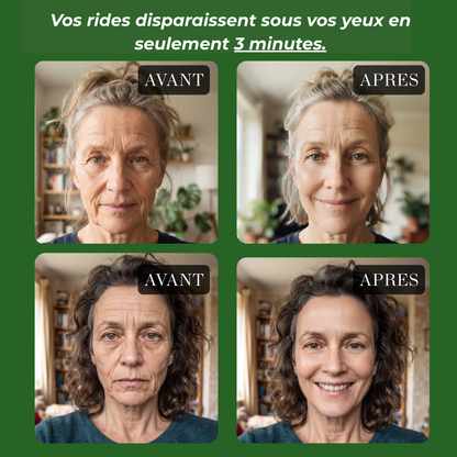 serum Anti ride