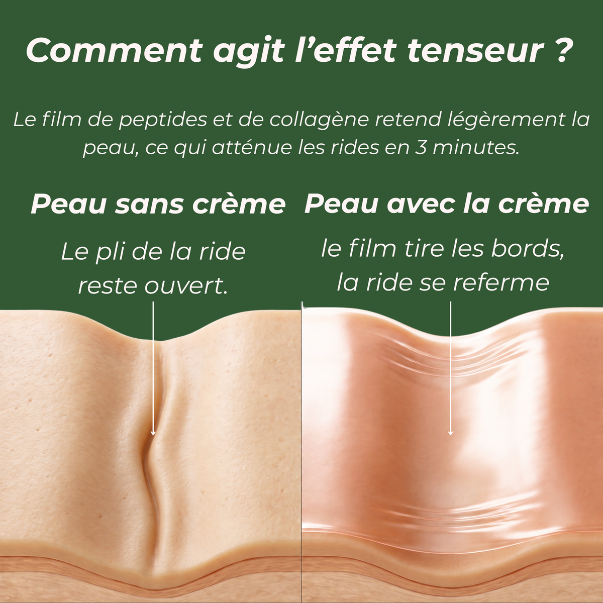 serum Anti ride